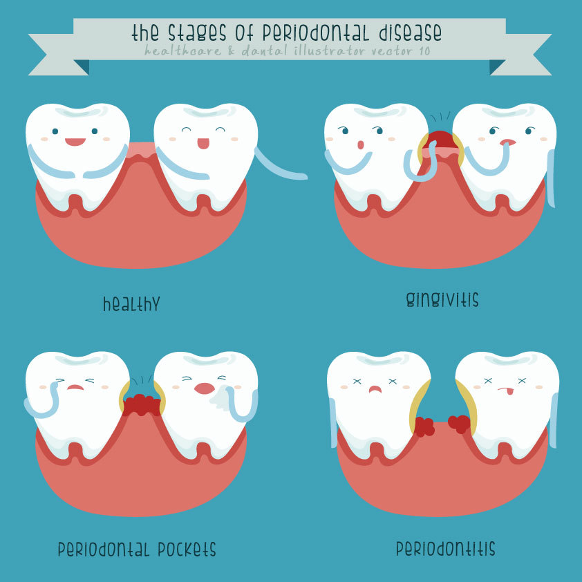 paradentosebehandling image