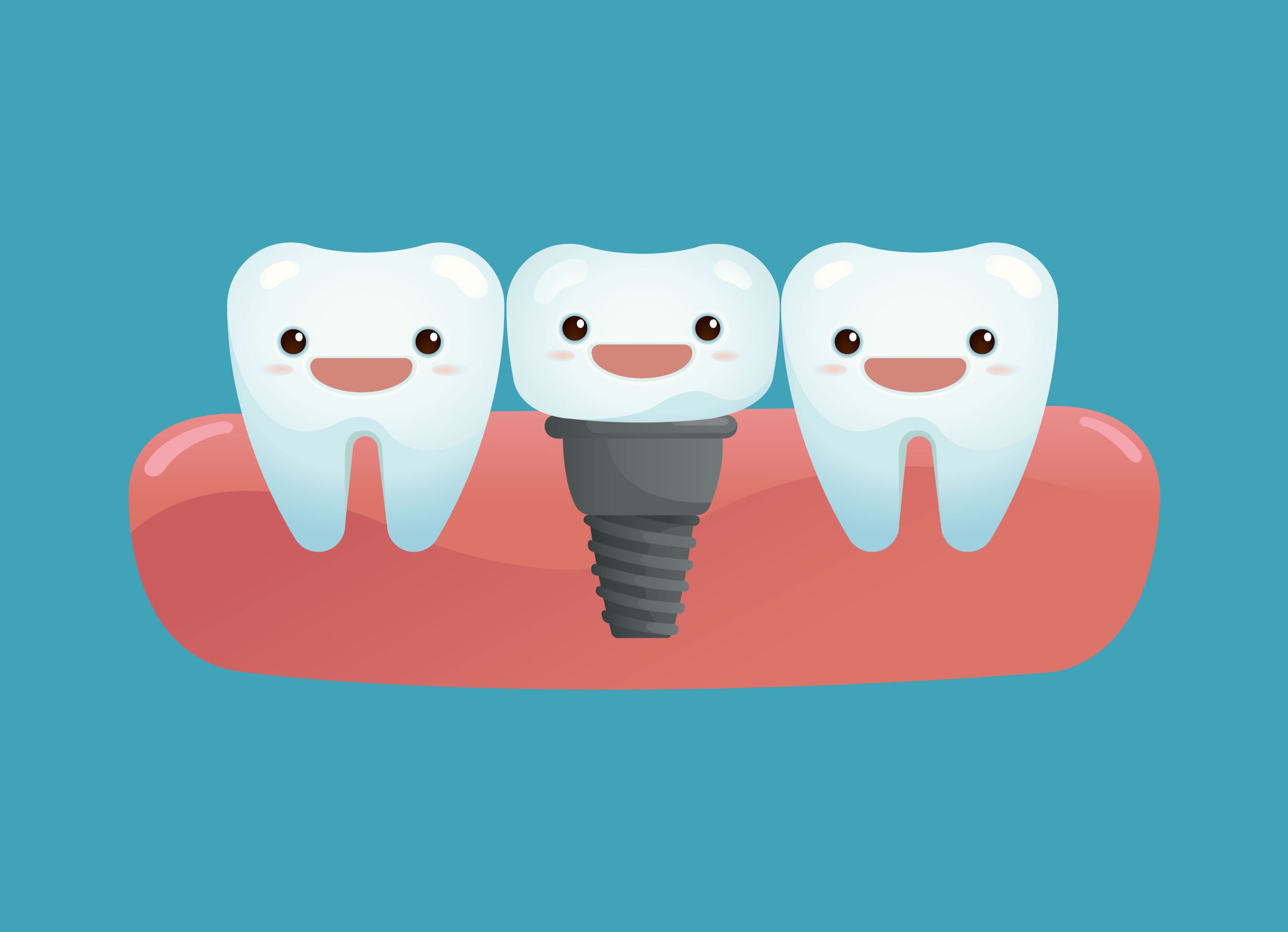 tanddk implantatbehandling image1